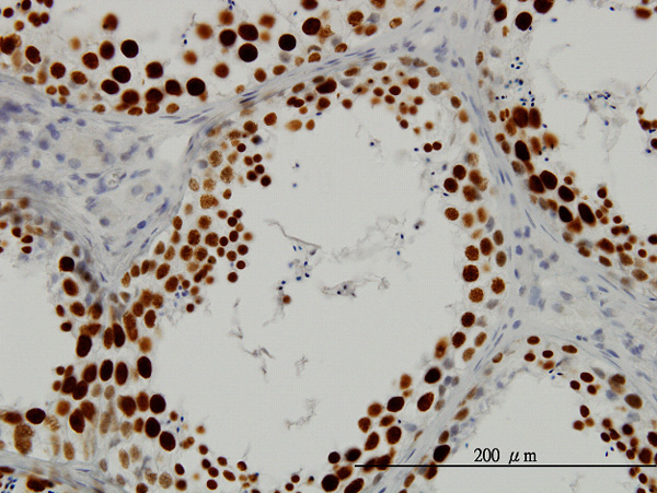 IHC - SFRS14 Antibody (monoclonal) (M01) AT3845a